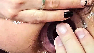 Arch. 1. Trying Anal Fisting