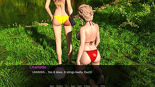 Nursing Back To Pleasure Sexy Girls In Bikini Are Playing Volleyball Ep 48